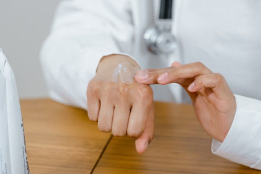 eczema dermatits